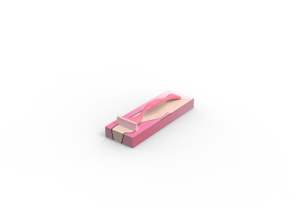 HairRemoval